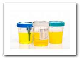 urine sample.jpg